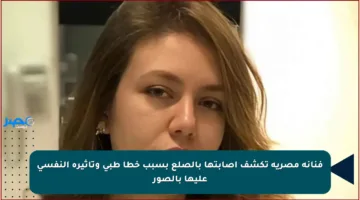 فنانة مصرية تكشف إصابتها بالصلع بسبب خطأ طبي وتأثيره النفسي عليها بالصور